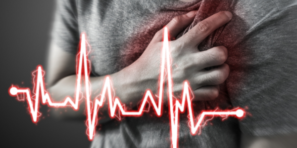 Heart attack prevention